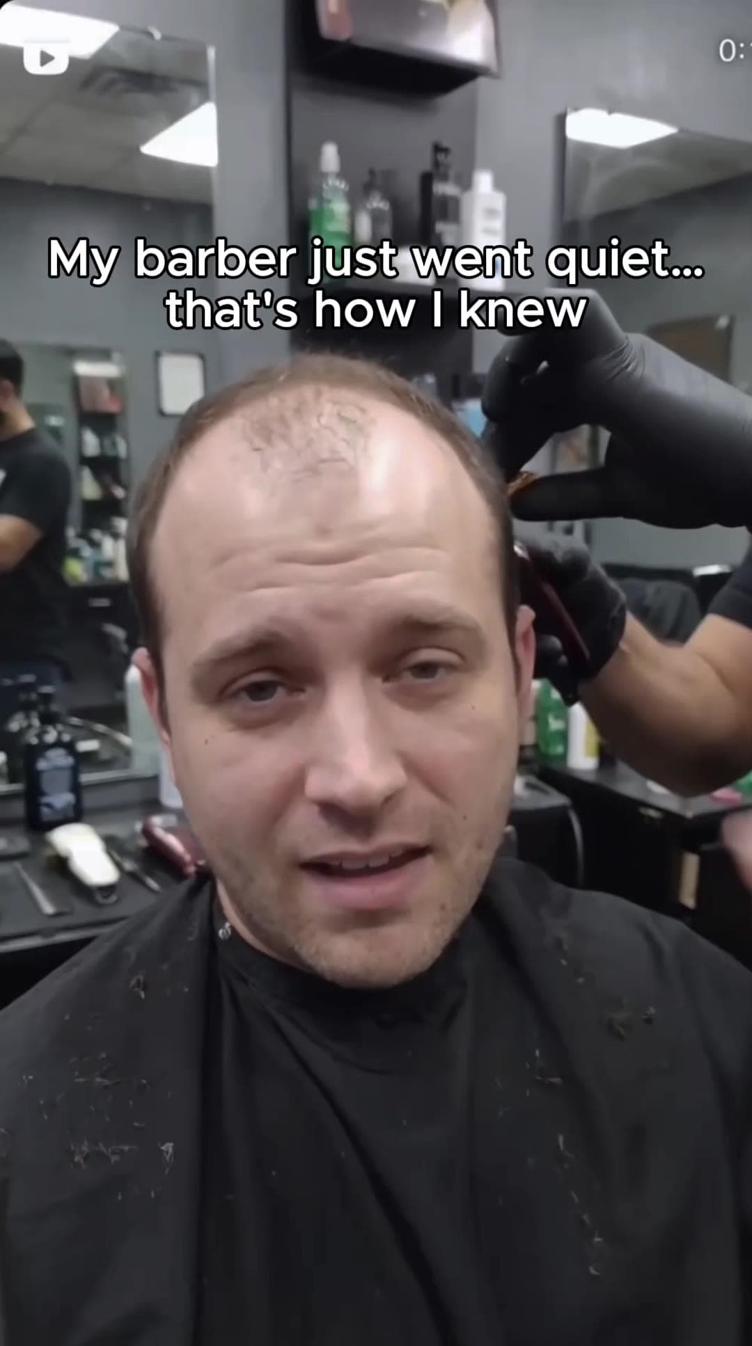 Hair Loss · Barbershop